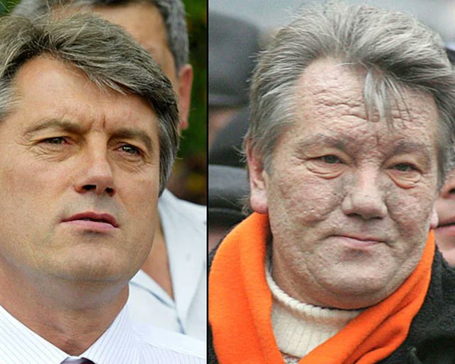 Viktor Yushchenko before and after poisoning by dioxin 2024